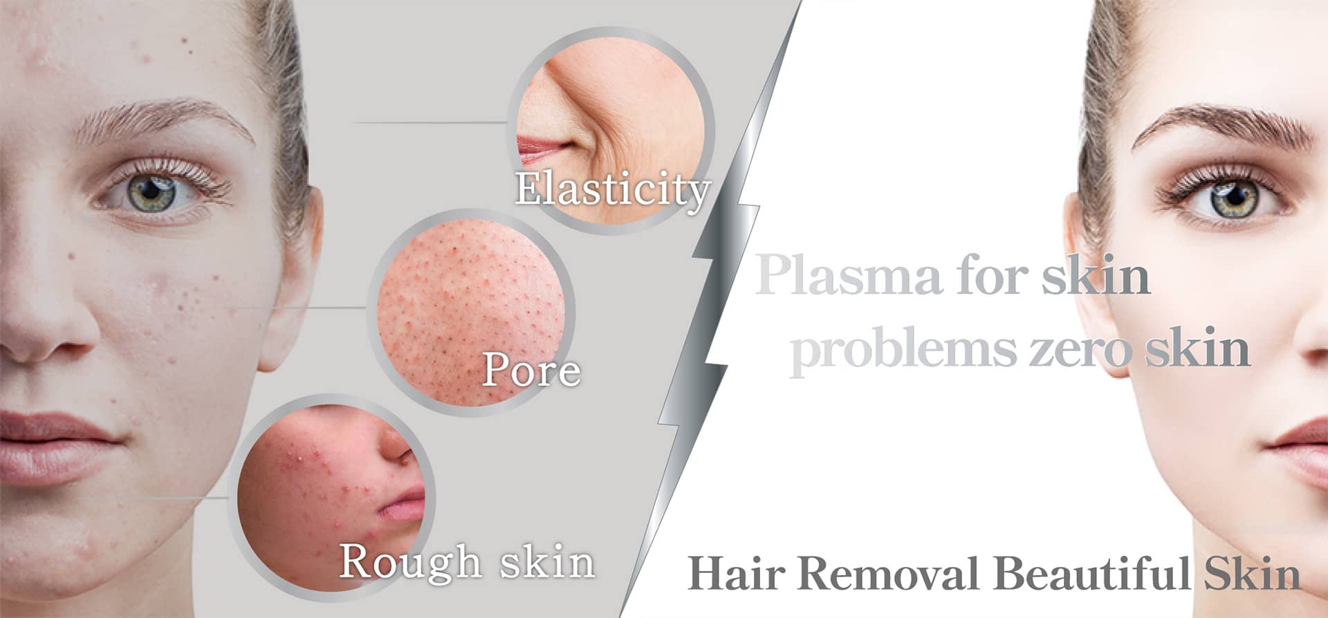 Plasma for skin / problems zero skin / Hair Removal Beautiful Skin